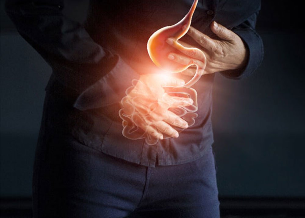 Homeopathic remedies for acid reflux, hyperacidity, and heartburn