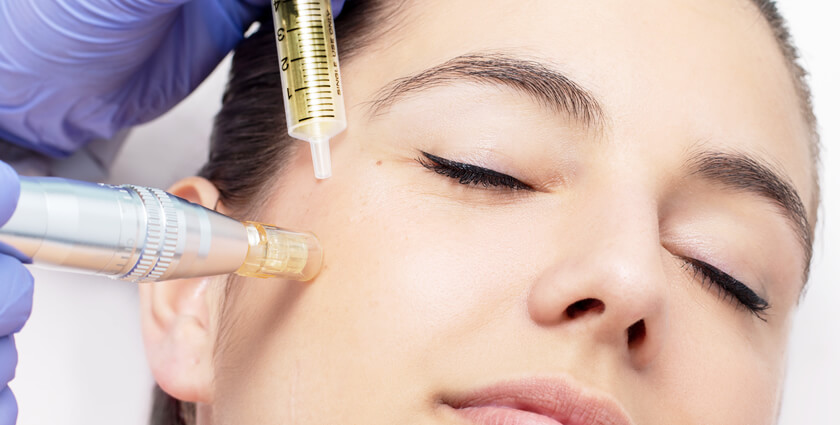 Mesotherapy Treatment for Skin Rejuvenation in Gwalior